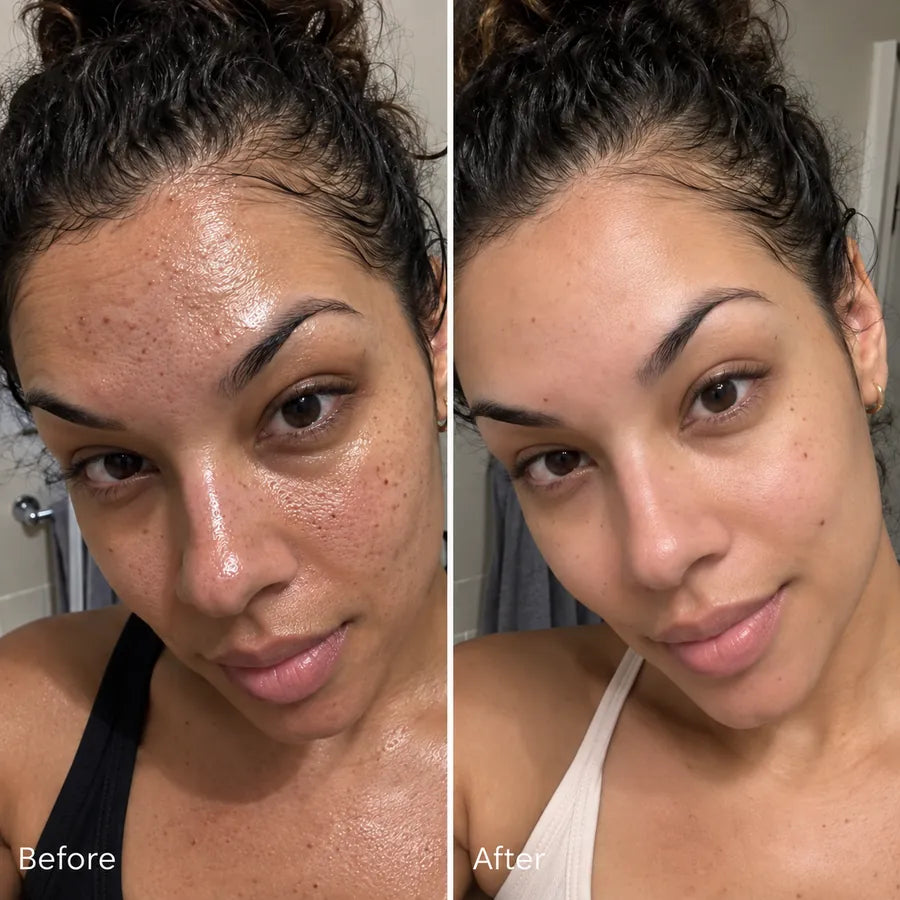 Before and after T-zone oil and pore skincare result