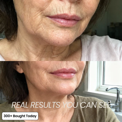 PDRN Collagen Plump & Repair Balm with Volufiline