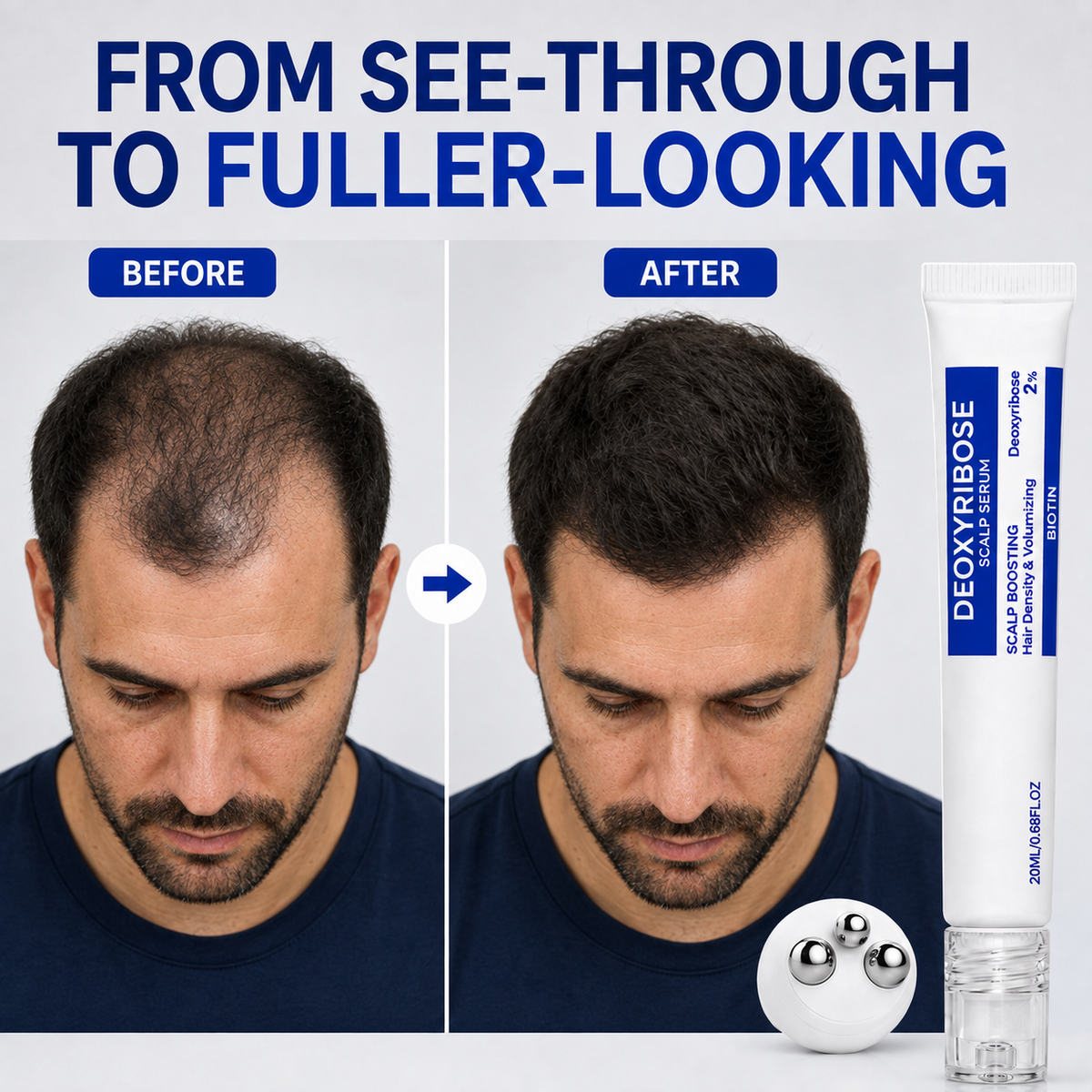 Deoxyribose Scalp Serum Roll-On