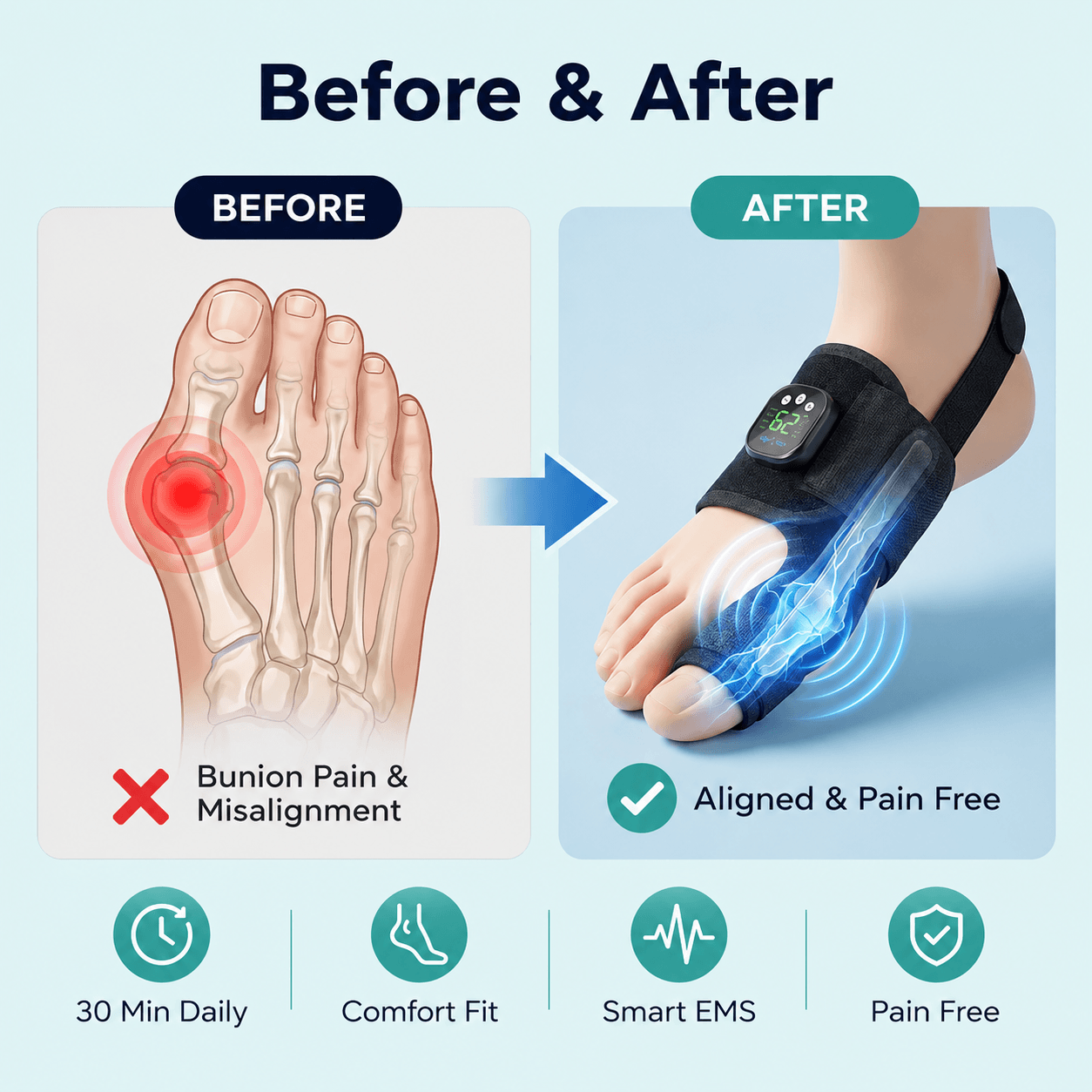 BuniVanta®  EMS Bunion Corrector