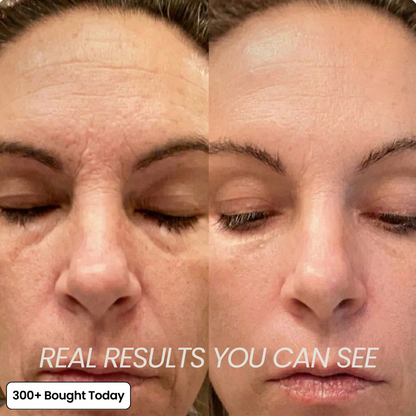 PDRN Collagen Plump & Repair Balm with Volufiline