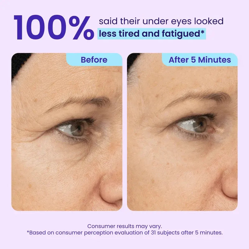 👑 LAST DAY — From Just $10.19/Each ✨ Instant Lift Eye Gel