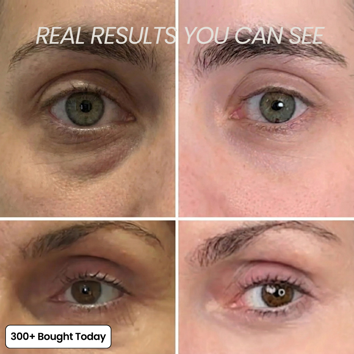 PDRN Collagen Plump & Repair Balm with Volufiline