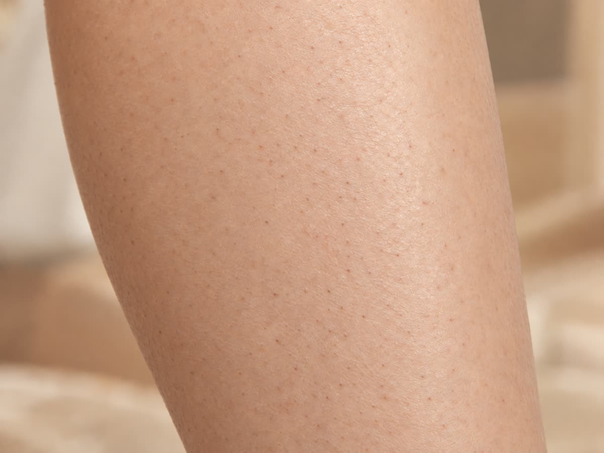 After close up of smoother-looking skin