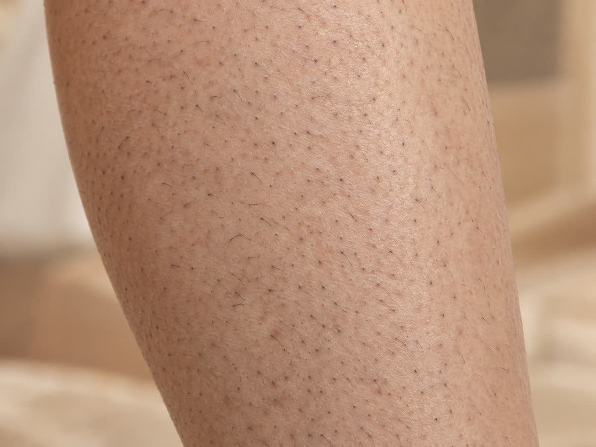 Before close up of visible short hair and stubble