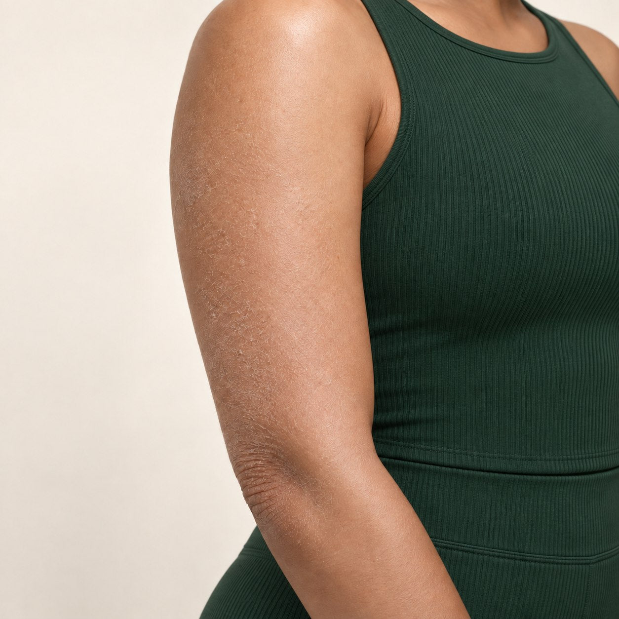 Dry loose-looking body skin before a moisturizing body-care routine