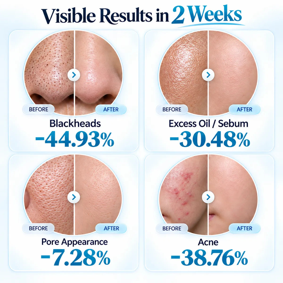 Dluvivo Zero Pore Pad visible results and pore care comparison visual