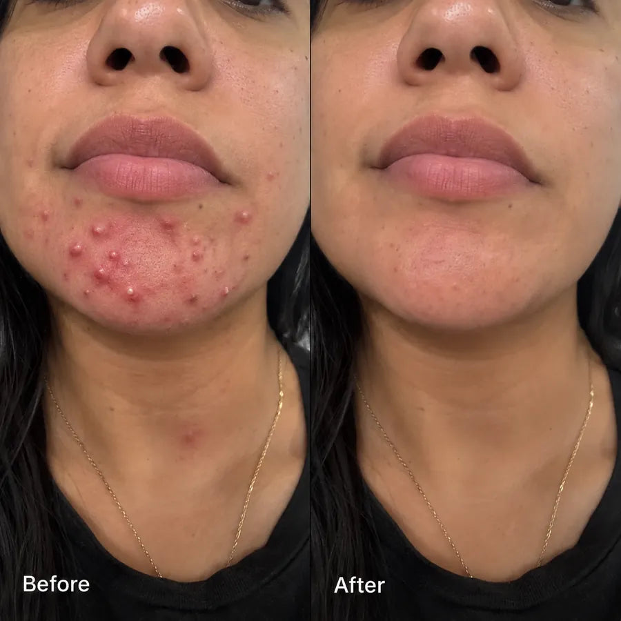 Before and after mature skin texture skincare result