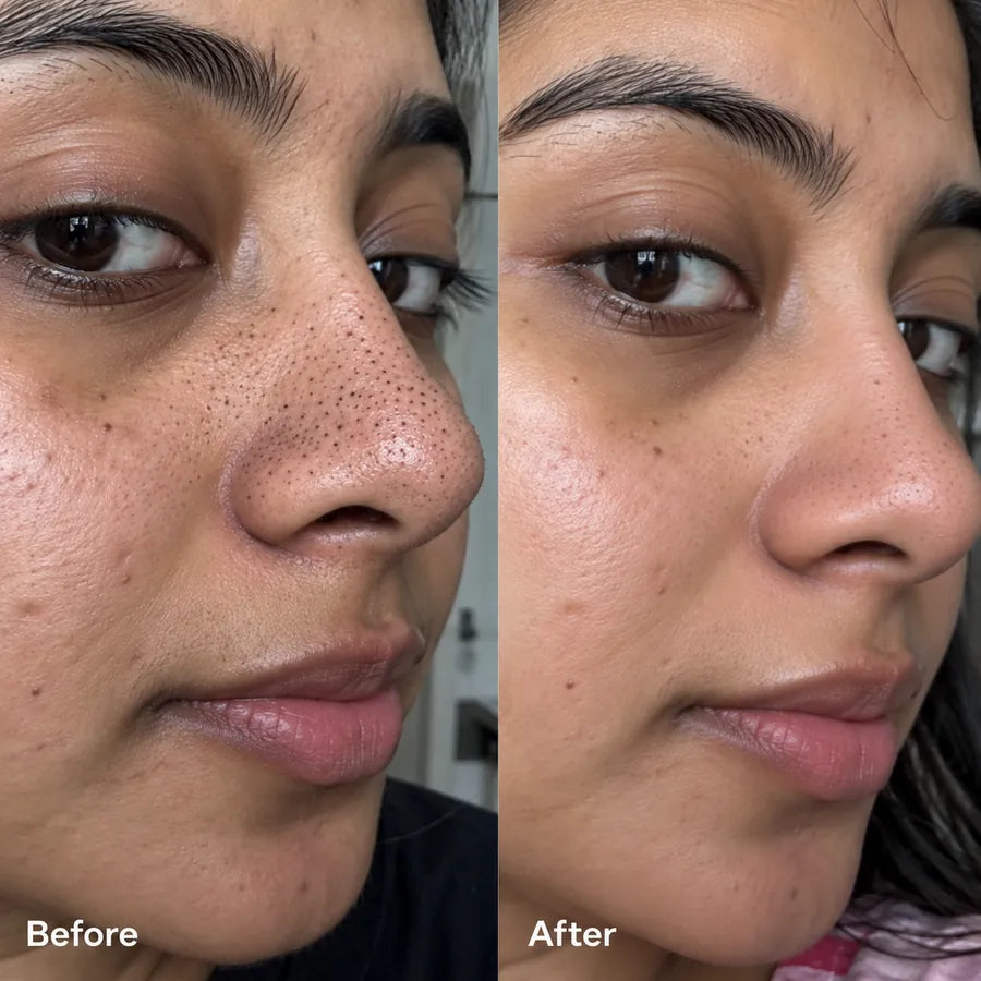 Before and after face texture skincare result