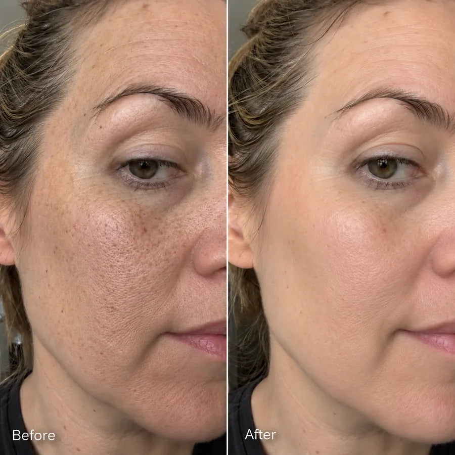 Before and after mature skin pore texture skincare result