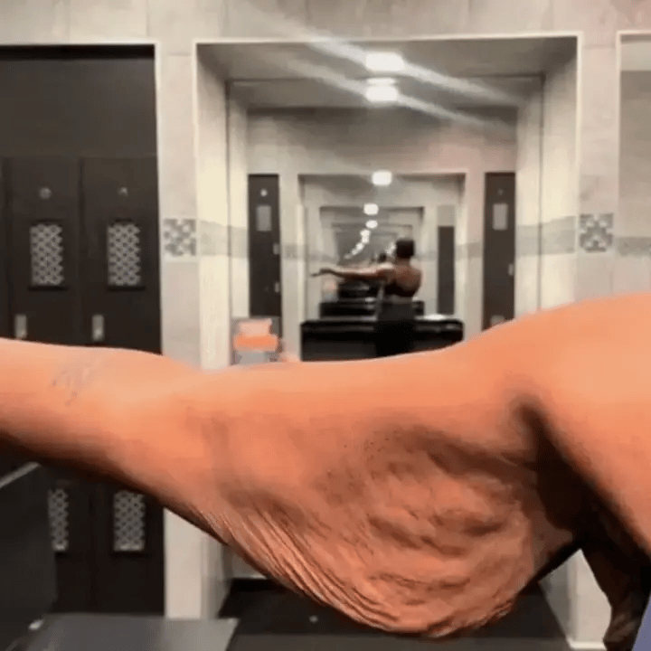 Visible skin texture concerns on the arms