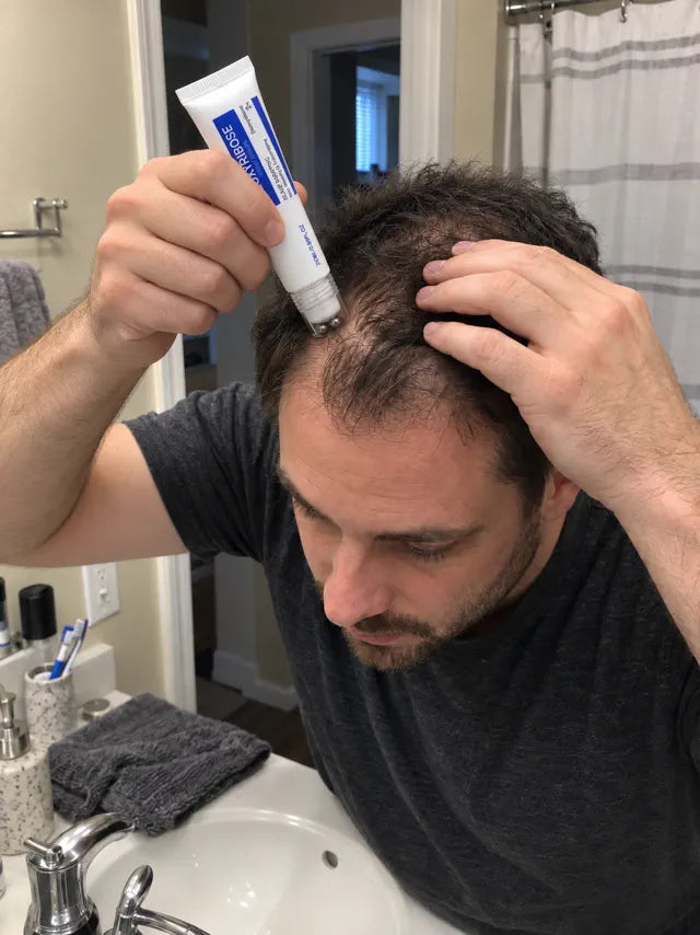 Man rolling scalp serum onto a thinning hairline in a bathroom mirror