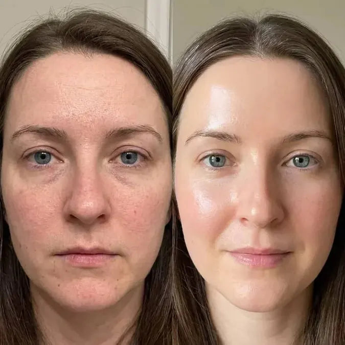 Skin comparison example 1