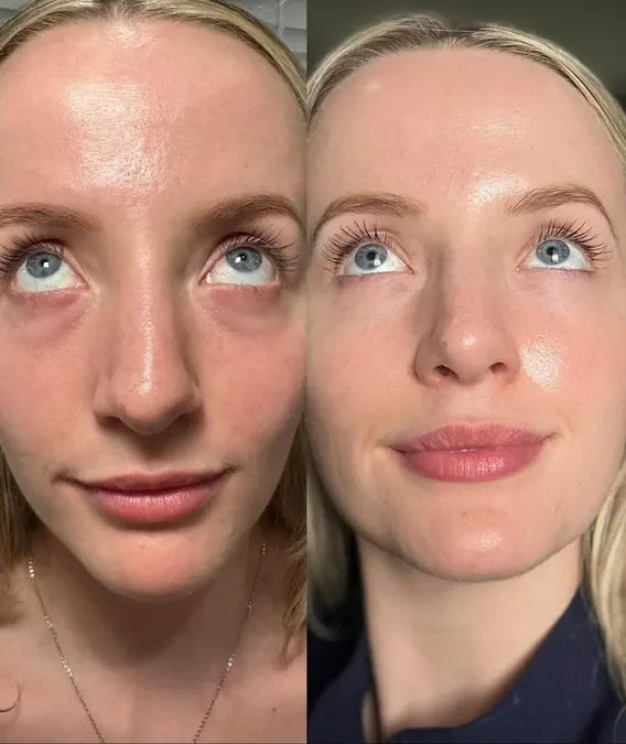 Skin comparison example 2