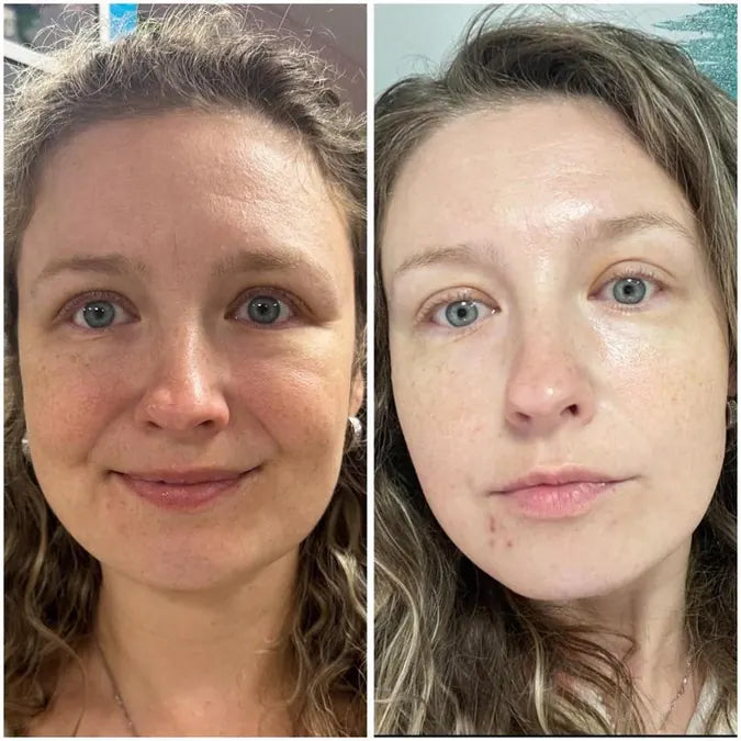 Skin comparison example 3
