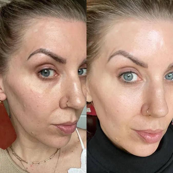 Skin comparison example 4