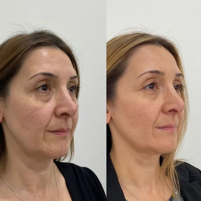 Skin comparison example 5