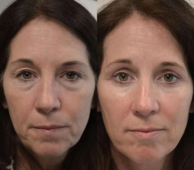 Skin comparison example 6