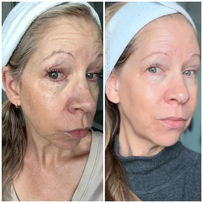 Skin comparison example 7