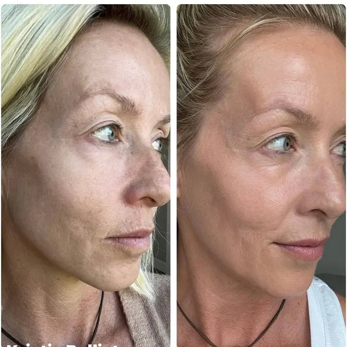 Skin comparison example 8
