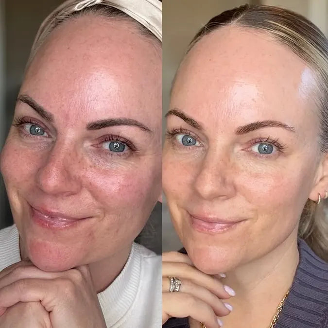 Skin comparison example 9