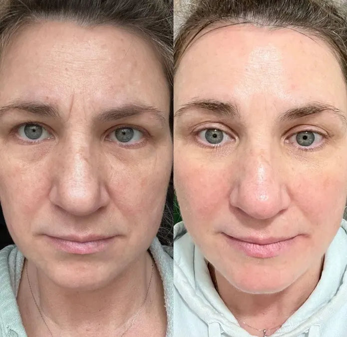 Skin comparison example 10