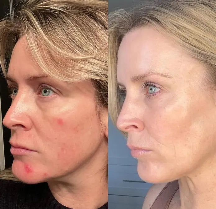 Skin comparison example 11