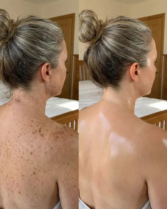 Skin comparison example 12