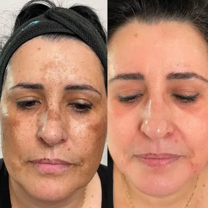 Skin comparison example 13