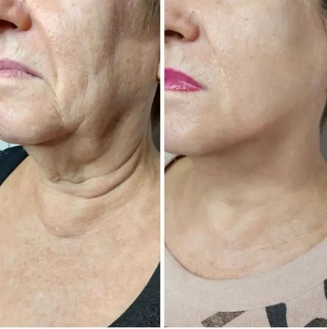 Skin comparison example 14