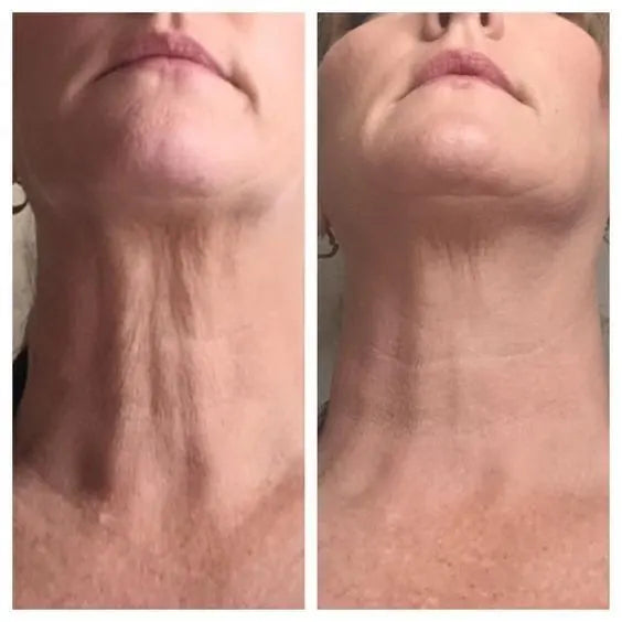 Skin comparison example 15