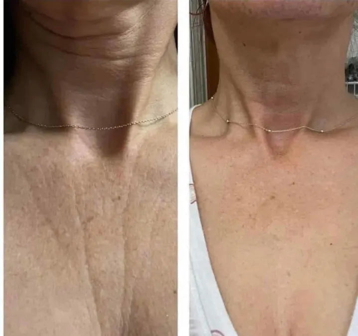 Skin comparison example 16